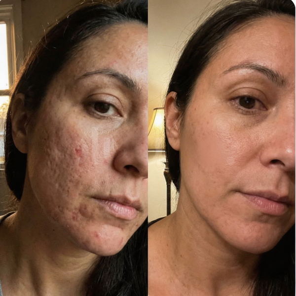 Carmen V, 35